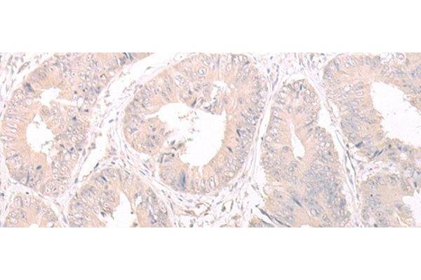 FOXRED2 antibody