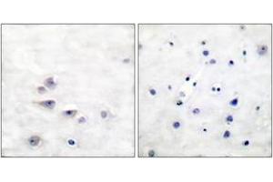 Immunohistochemistry (IHC) image for anti-SHC (Src Homology 2 Domain Containing) Transforming Protein 1 (SHC1) (AA 393-442), (pTyr427) antibody (ABIN1531194)