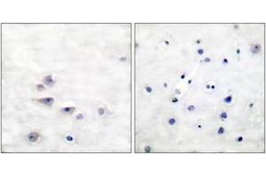Immunohistochemistry analysis of paraffin-embedded human brain, using Shc (Phospho-Tyr427) Antibody. (SHC1 antibody  (pTyr427))
