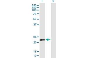 Western Blot analysis of CSH2 expression in transfected 293T cell line by CSH2 MaxPab polyclonal antibody. (CSH1 antibody  (AA 1-217))