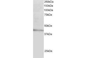 ABIN2561199 staining (3µg/ml) of Human Liver lysate (RIPA buffer, 30µg total protein per lane). (LDLRAP1 antibody  (N-Term))