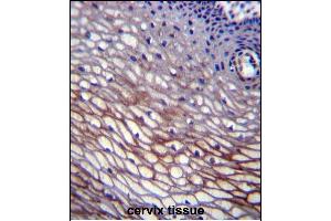 SKA2 Antibody (N-term) (ABIN656609 and ABIN2845866) immunohistochemistry analysis in formalin fixed and paraffin embedded human cervix tissue followed by peroxidase conjugation of the secondary antibody and DAB staining. (FAM33A antibody  (N-Term))