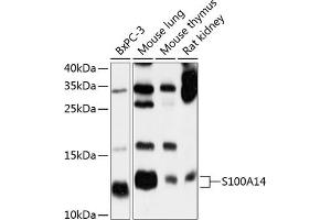 Western blot analysis of extracts of various cell lines, using S100 antibody (ABIN6128693, ABIN6147339, ABIN6147340 and ABIN6214636) at 1:1000 dilution.