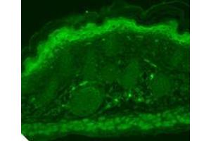 TrpV3 (S15 4), Human Hippocampus. (TRPV3 antibody  (AA 774-791))