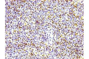IHC image of ABIN7127296 diluted at 1:100 and staining in paraffin-embedded human lymph node tissue performed on a Leica BondTM system. (Recombinant Histone H3.3 antibody)