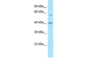 Host: Rabbit Target Name: MORN1 Sample Type: ACHN Whole Cell lysates Antibody Dilution: 1. (MORN1 antibody  (C-Term))