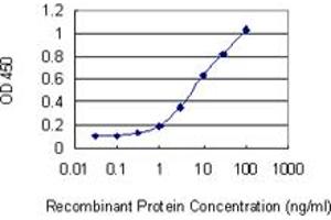 Detection limit for recombinant GST tagged DHRS2 is 0. (DHRS2 antibody  (AA 229-300))