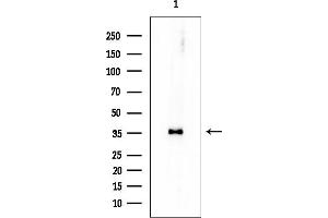 anti-Thiosulfate Sulfurtransferase (Rhodanese) (TST) antibody