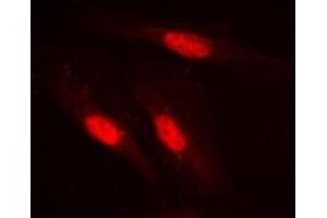 Immunofluorescent analysis of SMAD2 staining in Jurkat cells. (SMAD2 antibody  (Center))