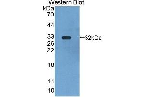 Detection of Recombinant LRDD, Mouse using Polyclonal Antibody to Leucine Rich Repeats And Death Domain Containing Protein (LRDD) (Leucine Rich Repeats And Death Domain Containing Protein (AA 666-915) antibody)