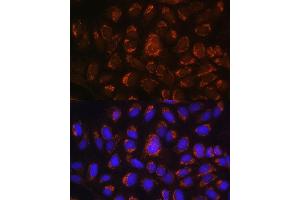 Immunofluorescence analysis of U-2 OS cells using  antibody (ABIN6129884, ABIN6137152, ABIN6137153 and ABIN6214229) at dilution of 1:100. (ART1 antibody  (AA 23-295))