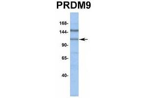 Host:  Rabbit  Target Name:  PRDM9  Sample Type:  HepG2  Antibody Dilution:  1.