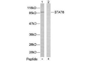 Image no. 2 for anti-Signal Transducer and Activator of Transcription 6, Interleukin-4 Induced (STAT6) (Thr645) antibody (ABIN197186) (STAT6 antibody  (Thr645))