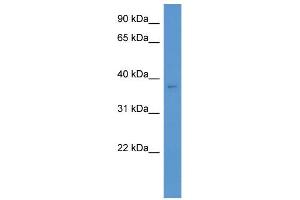 WB Suggested Anti-Cacng3 Antibody Titration: 0. (CACNG3 antibody  (C-Term))