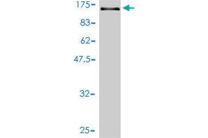 Western Blot detection against Immunogen (143 KDa) . (Vinculin antibody  (AA 1-1066))