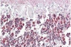 Immunohistochemistry (IHC) image for anti-Epilepsy, Progressive Myoclonus Type 2A, Lafora Disease (Laforin) (EPM2A) (Internal Region) antibody (ABIN2466629) (EPM2A antibody  (Internal Region))