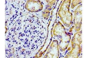 Immunohistochemistry of paraffin-embedded human kidney tissue using ABIN7164870 at dilution of 1:100 (PTGR2 antibody  (AA 206-282))