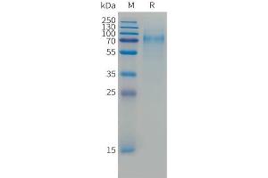 SDS-PAGE (SDS) image for Tumor Necrosis Factor Receptor Superfamily, Member 8 (TNFRSF8) (AA 28-393) protein (His tag) (ABIN7538583)