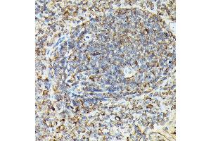 Immunohistochemistry of paraffin-embedded rat spleen using Phospho-VASP-S239 Rabbit pAb (ABIN3019748, ABIN3019749, ABIN3019750, ABIN1682137 and ABIN1682138) at dilution of 1:50 (40x lens). (VASP antibody  (pSer239))