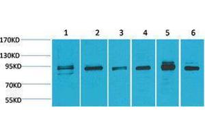 Western Blotting (WB) image for anti-Mitogen-Activated Protein Kinase 7 (MAPK7) antibody (ABIN3181518) (MAPK7 antibody)