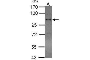 RAD54B 抗体  (C-Term)