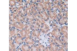 #VALUE! (XYLT2 antibody  (AA 596-865))