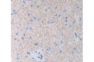 Immunohistochemistry (IHC) image for anti-Aryl Hydrocarbon Receptor Interacting Protein (AIP) (AA 63-296) antibody (ABIN5013159)