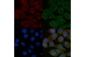 ABIN6257077 and ABIN6275765 staining Hela cells(30 min of UV treatment) by IF/ICC.