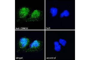 (ABIN185622) Immunofluorescence analysis of paraformaldehyde fixed U251 cells, permeabilized with 0. (Casein Kinase 1 delta antibody  (Internal Region))
