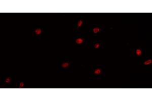 ABIN6266854 staining K-562 cells by IF/ICC. (PRKDC antibody  (Internal Region))