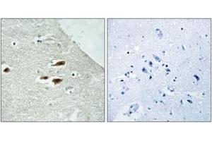 Immunohistochemistry analysis of paraffin-embedded human brain, using Period Circadian Protein 2 (Phospho-Ser662) Antibody. (PER2 antibody  (pSer662))