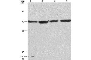 Western blot analysis of HUVEC, NIH/3T3, Hela and 293T cell, using KLF11 Polyclonal Antibody at dilution of 1:475