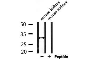 Western blot analysis of extracts from mouse kidney, using CBR1 Antibody. (CBR1 antibody  (C-Term))