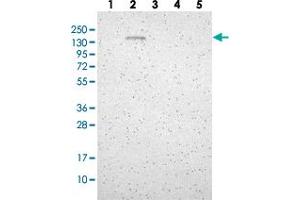Western blot analysis of Lane 1: RT-4, Lane 2: U-251 MG, Lane 3: Human Plasma, Lane 4: Liver, Lane 5: Tonsil with GLG1 polyclonal antibody  at 1:250-1:500 dilution. (GLG1 antibody)