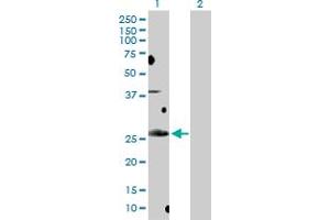 Western Blot analysis of BCL7B expression in transfected 293T cell line by BCL7B MaxPab polyclonal antibody. (BCL7B antibody  (AA 1-202))