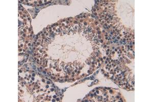 Used in DAB staining on fromalin fixed paraffin- embedded Kidney tissue (PTTG1 antibody  (AA 2-199))