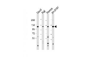 All lanes : Anti-LILRB1 Antibody (Center) at 1:500-1:2000 dilution Lane 1: Daudi whole cell lysate Lane 2: Raji whole cell lysate Lane 3: Ramos whole cell lysate Lane 4: SH-SY5Y whole cell lysate Lysates/proteins at 20 μg per lane. (LILRB1 antibody  (AA 345-374))