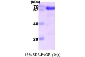 SDS-PAGE (SDS) image for Usher Syndrome 1C (Autosomal Recessive, Severe) (USH1C) (AA 1-533) protein (His tag) (ABIN667114)