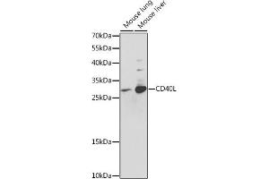 Western blot analysis of extracts of various cell lines, using CD40L antibody (ABIN3020936, ABIN3020937, ABIN3020938 and ABIN6213807) at 1:400 dilution. (CD40 Ligand antibody  (AA 47-223))