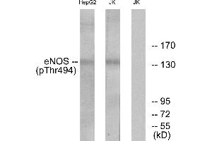 Western blot analysis of extracts from Jurkat cells and HepG2 cells, using eNOS (Phospho-Thr494) antibody. (ENOS antibody  (pThr494))