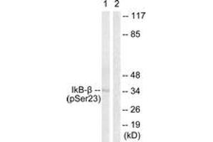Western blot analysis of extracts from HeLa cells treated with TNF-a 20ng/ml 5', using IkappaB-beta (Phospho-Ser23) Antibody. (NFKBIB antibody  (pSer23))