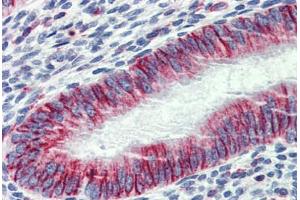 Uterus, Human: Formalin-Fixed, Paraffin-Embedded (FFPE)