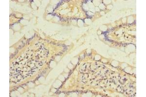 Immunohistochemistry of paraffin-embedded human small intestine tissue using ABIN7167369 at dilution of 1:100 (RAB6B antibody  (AA 2-208))