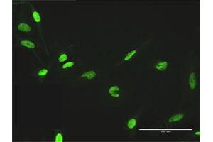 Immunofluorescence of purified MaxPab antibody to ZNF530 on HeLa cell. (ZNF530 antibody  (AA 1-599))