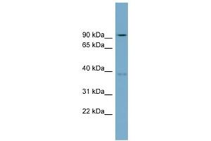 WB Suggested Anti-RTDR1 Antibody Titration: 0. (RTDR1 antibody  (N-Term))