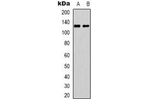 Western blot analysis of UBE3B expression in HEK293T (A), Jurkat (B) whole cell lysates. (UBE3B antibody)