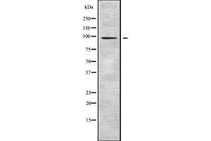 Western blot analysis SLC39A10 using HepG2 whole cell lysates