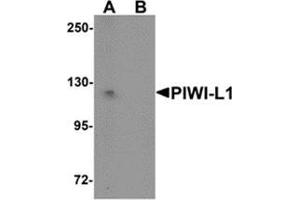 Western blot analysis of PIWI-L1 in HepG2 cell lysate with PIWI-L1 antibody at 1 μg/ml in (A) the absence and (B) the presence of blocking peptide. (PIWIL1 antibody  (N-Term))