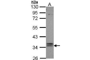 WB Image Sample (30 ug of whole cell lysate) A: Hep G2 , 10% SDS PAGE antibody diluted at 1:1000 (GPBAR1 antibody  (C-Term))