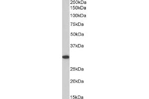 ANP32B antibody  (C-Term)